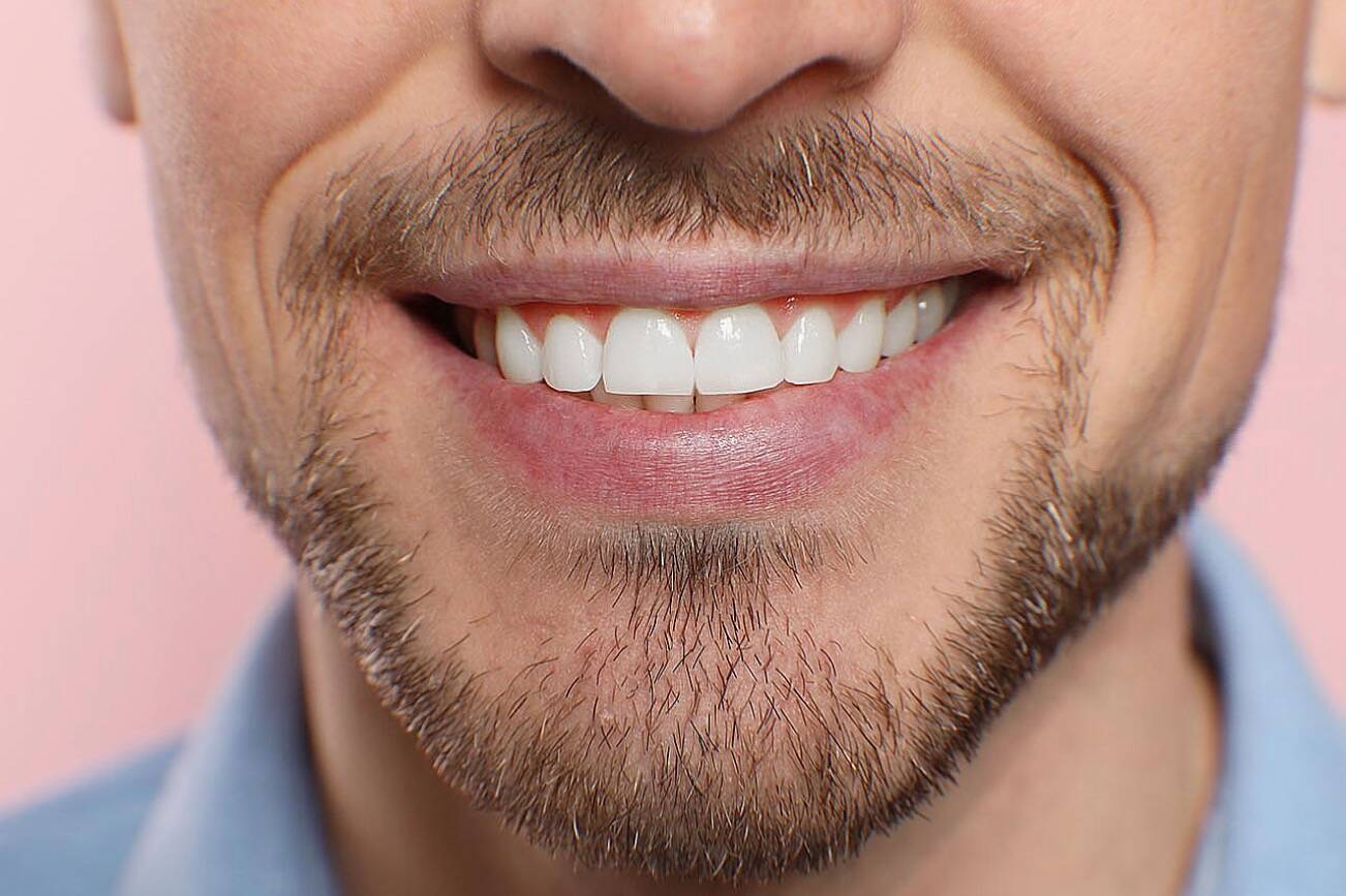 Best Teeth Whitening Kits Ranked | The Daily World