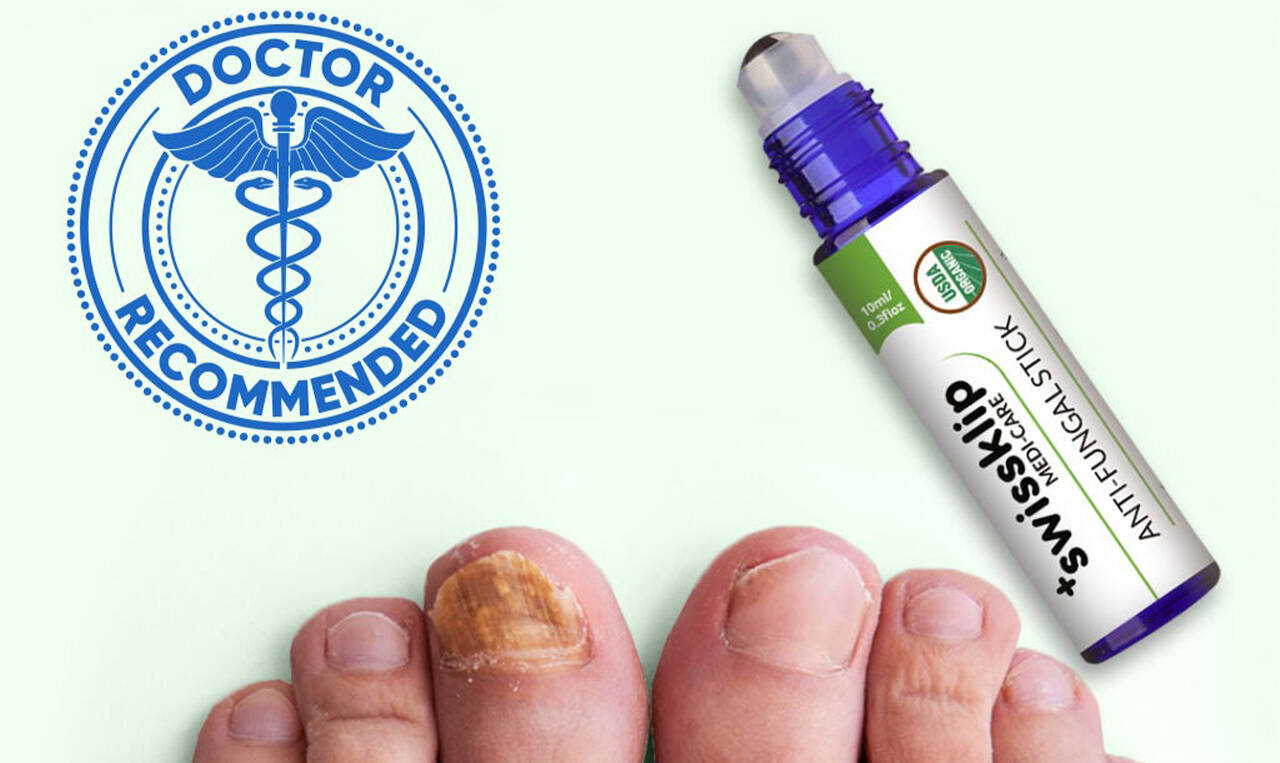 Swissklip AntiFungal Stick Review Does It Work to Kill Nail Fungus