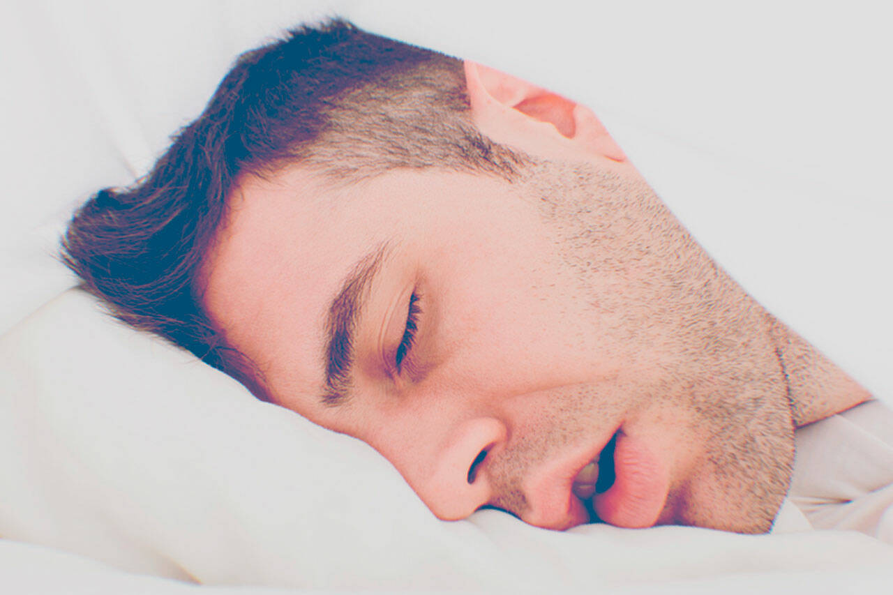 Best AntiSnoring Mouthpieces Top Snoring Support Mouthguard Devices