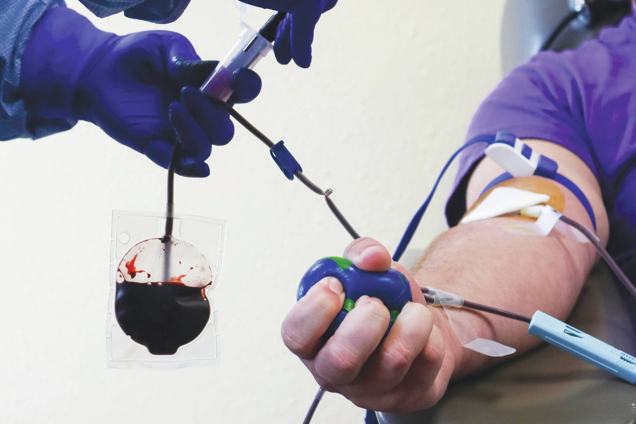 Blood levels in Washington are at a low ebb, according to nonprofit donation agency Bloodworks NW. (Ben Hohenstatt / Juneau Empire File)