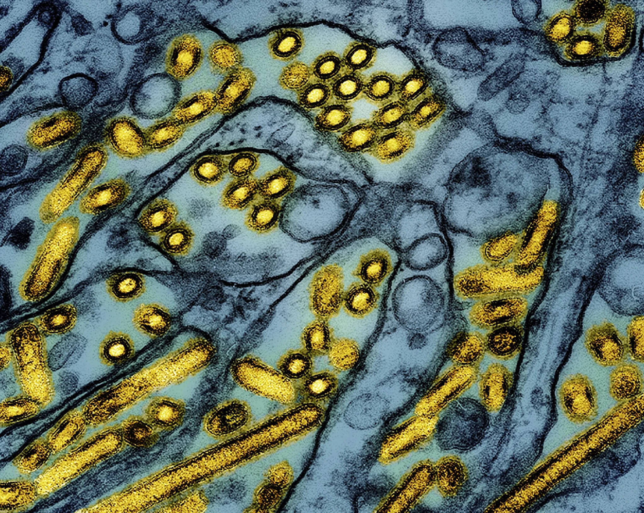 CDC / NIAID via AP, 2024
This colorized electron microscope image shows bird flu A H5N1 virus particles (yellow) grown in Madin-Darby Canine Kidney epithelial cells (blue).