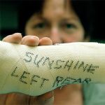 Sunshine the dog takes the first steps toward her new hind legs