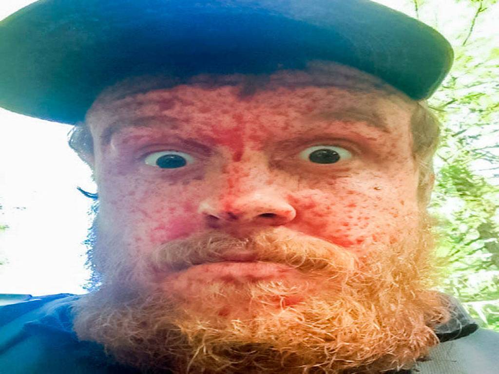 William Haynes poses for a selfie that shows his face speckled with bear blood after an alleged poaching incident outside of Randle off Forest Road 23 on Sept. 26, 2015. He reportedly sent this picture to his mother. (WDFW)